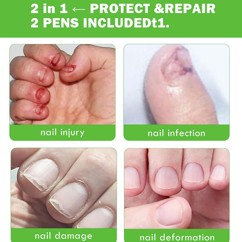 Nail Bitter Water