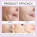 Reusable V-Face Lifting Invisible Tape
